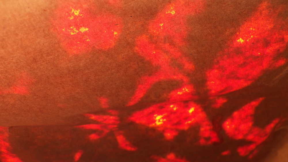 roter_rorschach